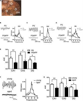 Histone Deacetylase Inhibitor Improves the Dysfunction of Hippocampal Gamma Oscillations and Fast Spiking Interneurons in Alzheimer’s Disease Model Mice
